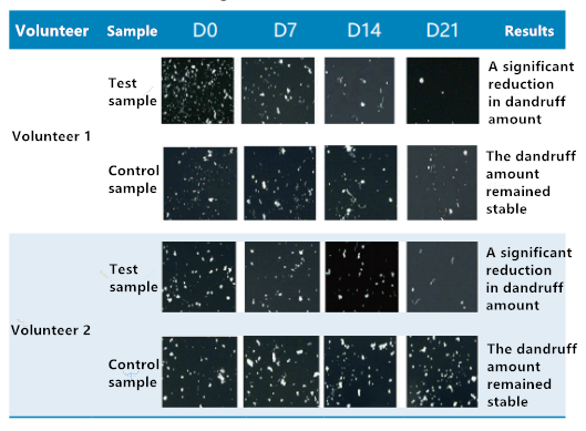 Scalp,health,Cosmetc,Efficacy,Evaluation