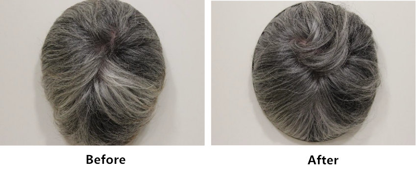 Scalp,health,Cosmetc,Efficacy,Evaluation